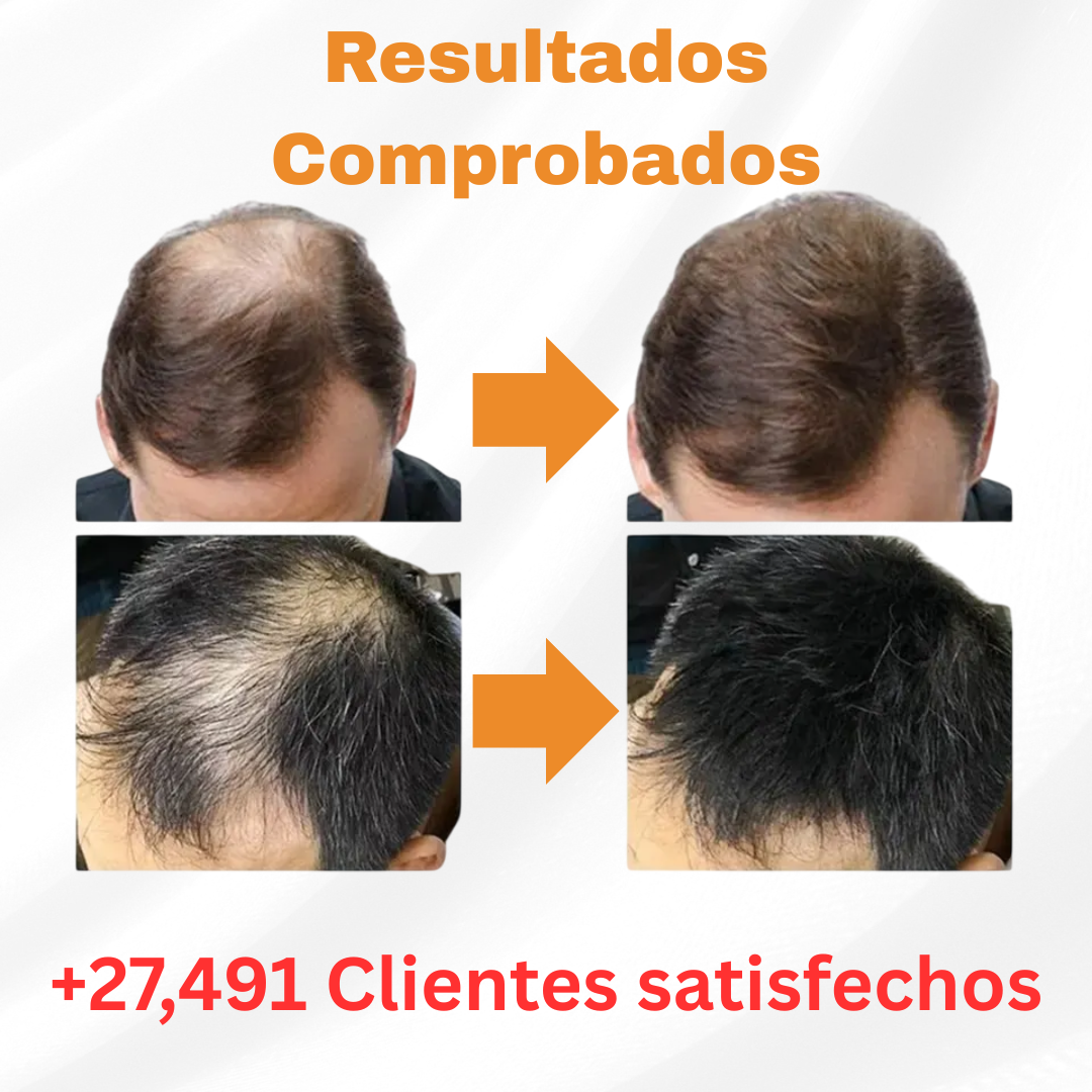 Disaar™ - Fibra Capilar 3 en 1: Volumen, Nutrición y Fijación