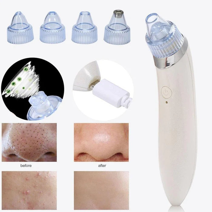 PureSkin™ - Succionador de Puntos Negros + 4 Cabezales de REGALO