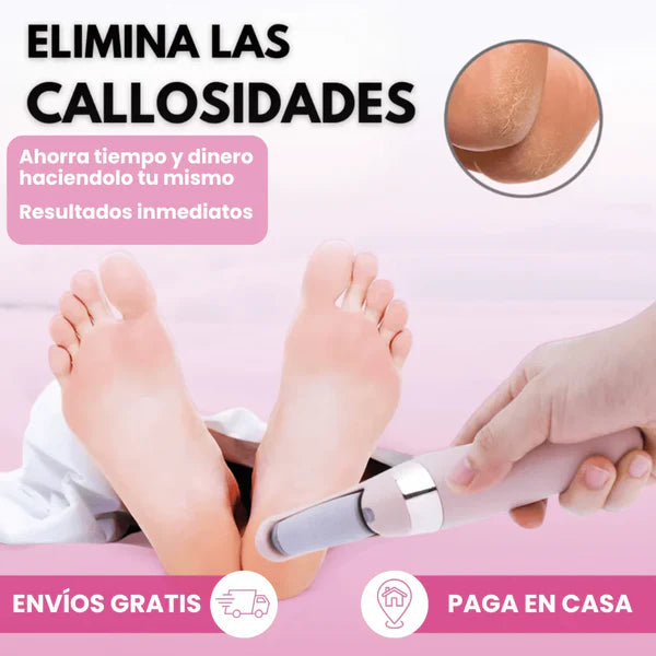Softy® | Elimina Callos Duros en 5 Minutos