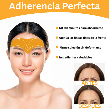 SmoothSkin Parches Antiarrugas para la Frente – Pack 10 Unidades ✨