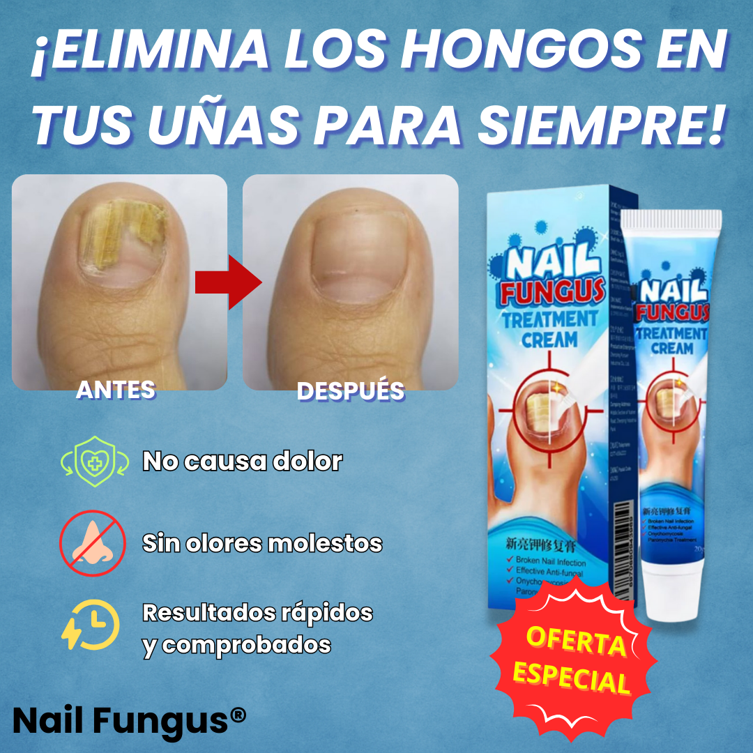 Nail Fungus® | Crema Anti Hongos para Uñas y Pies