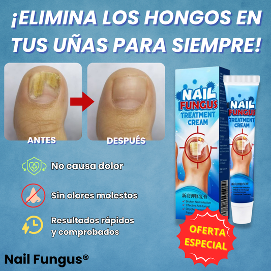 Nail Fungus® | Crema Anti Hongos para Uñas y Pies