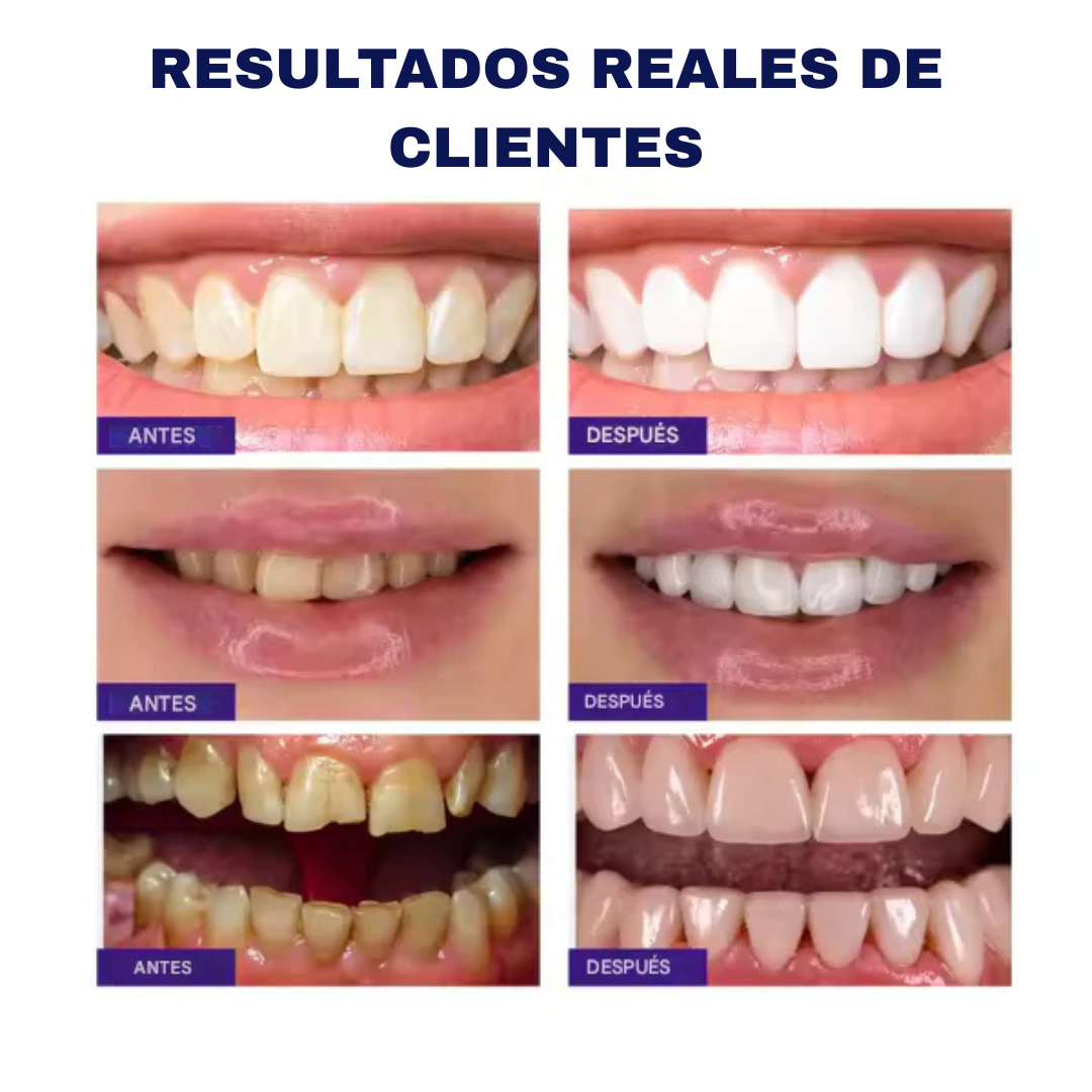 Dazzling White™ ORIGINAL 2x1 - Blanqueador Instantáneo