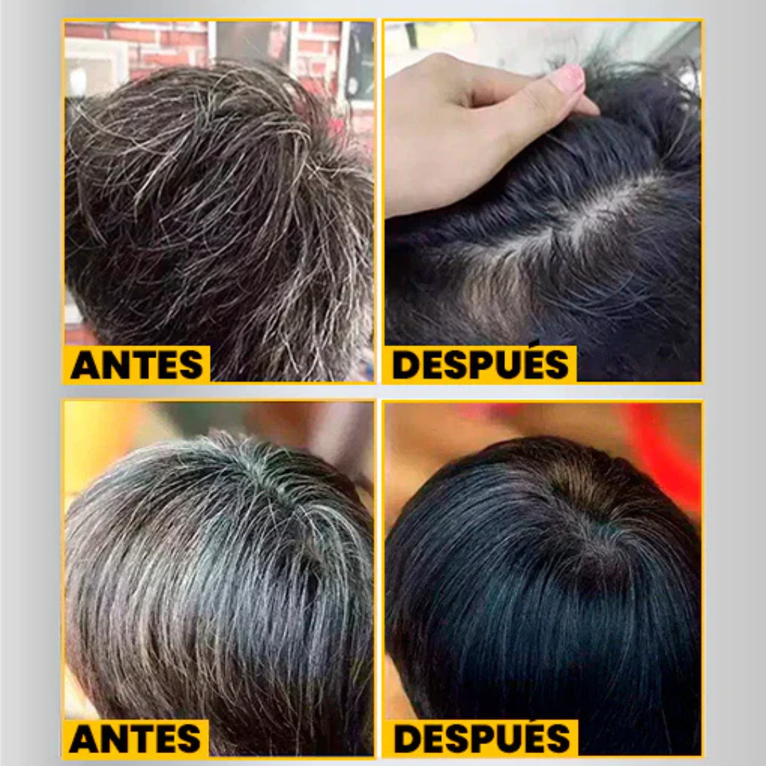 Dr Rashel Cubre Cana Original - Sin Químicos | Unisex