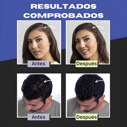 Toppík® Original | Fibra Capilar